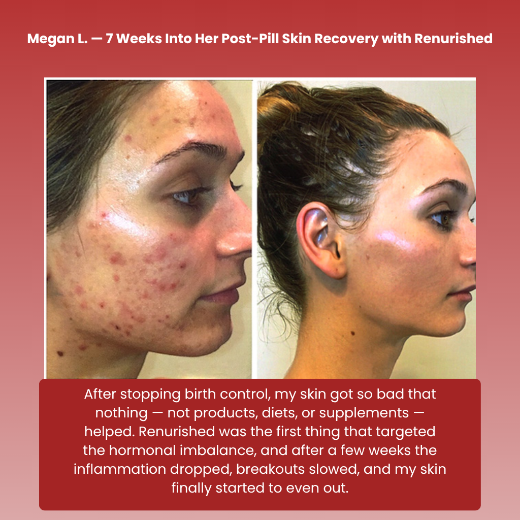 Renurished Skin Balance