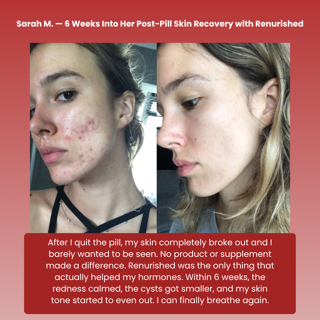 Renurished Skin Balance