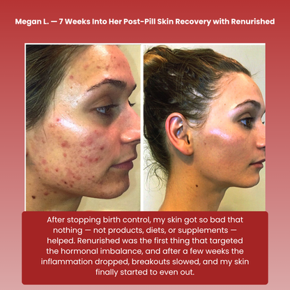 Renurished Skin Balance