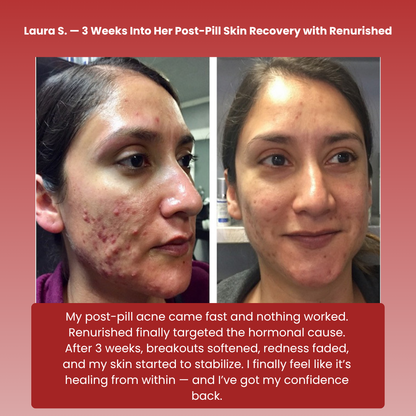 Renurished Skin Balance